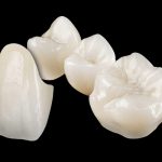 zirconia-based-dental-materials-market-size-to-reach-$3643-million-by-2028:-grand-view-research,-inc.