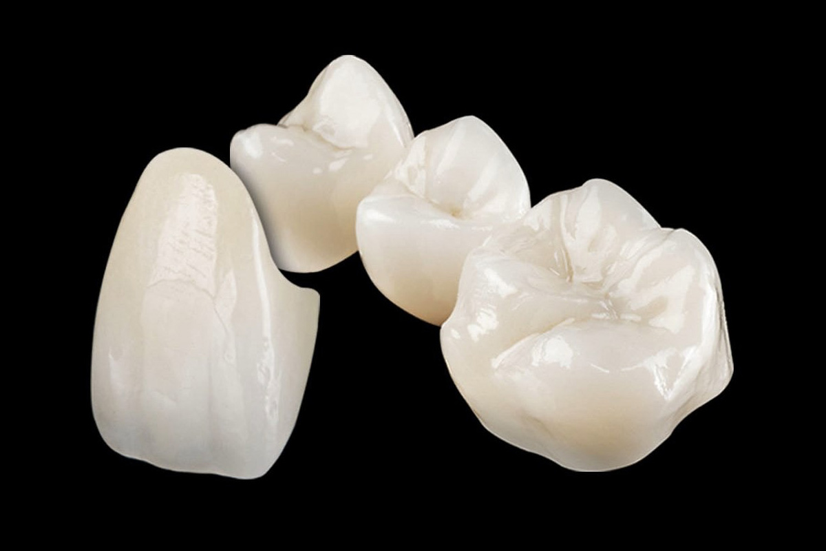 zirconia-based-dental-materials-market-size-to-reach-$3643-million-by-2028:-grand-view-research,-inc.